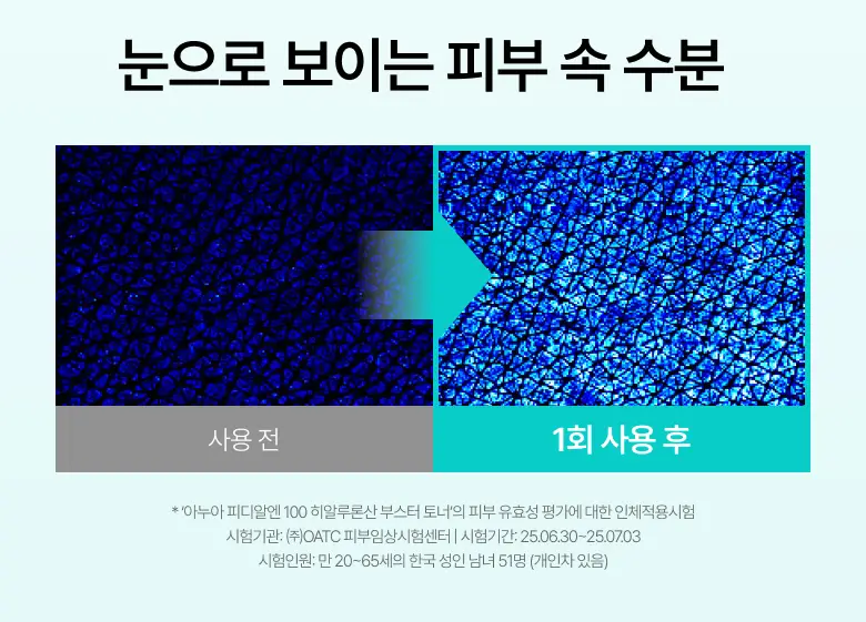 [수지 PICK] 아누아 피디알엔 100 히알루론산 부스터 토너 250ml 기획 (+40ml) 상세페이지 12